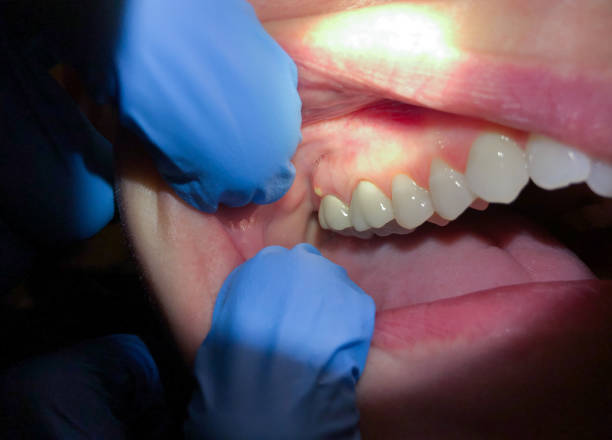 Best Emergency Cosmetic Dentistry (e.g., broken veneers) in Sandoval, IL
