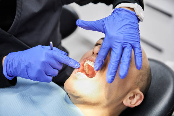Best Emergency Root Canal Therapy in Sandoval, IL