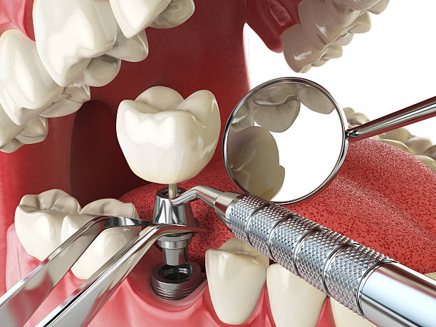 Best 24-Hour Emergency Dental Care in Sandoval, IL